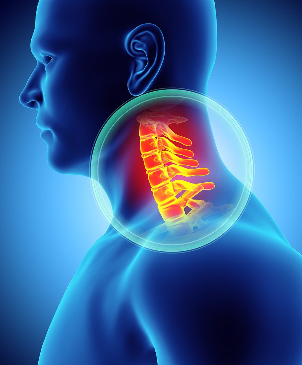 Should You Let a Chiropractor Adjust Your Neck?