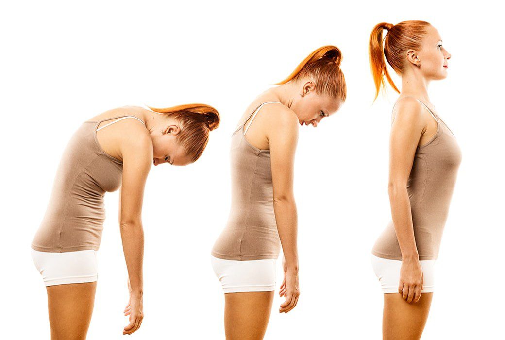 Can Poor Posture Result in Back Pain? A Physical Therapist Explains