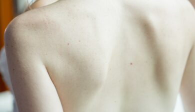 How to Treat Uneven Shoulders?