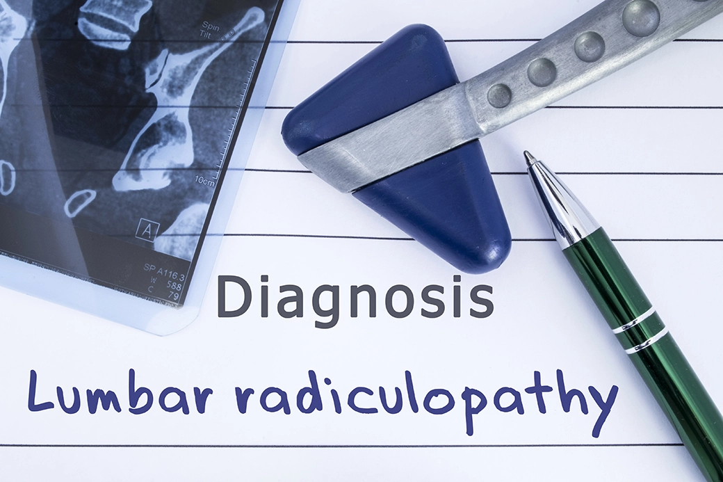 A knee reflex checking hammer, an x-ray image and a pen on a notebook page, that has the written title "Diagnosis Lumbar Radiculopathy"