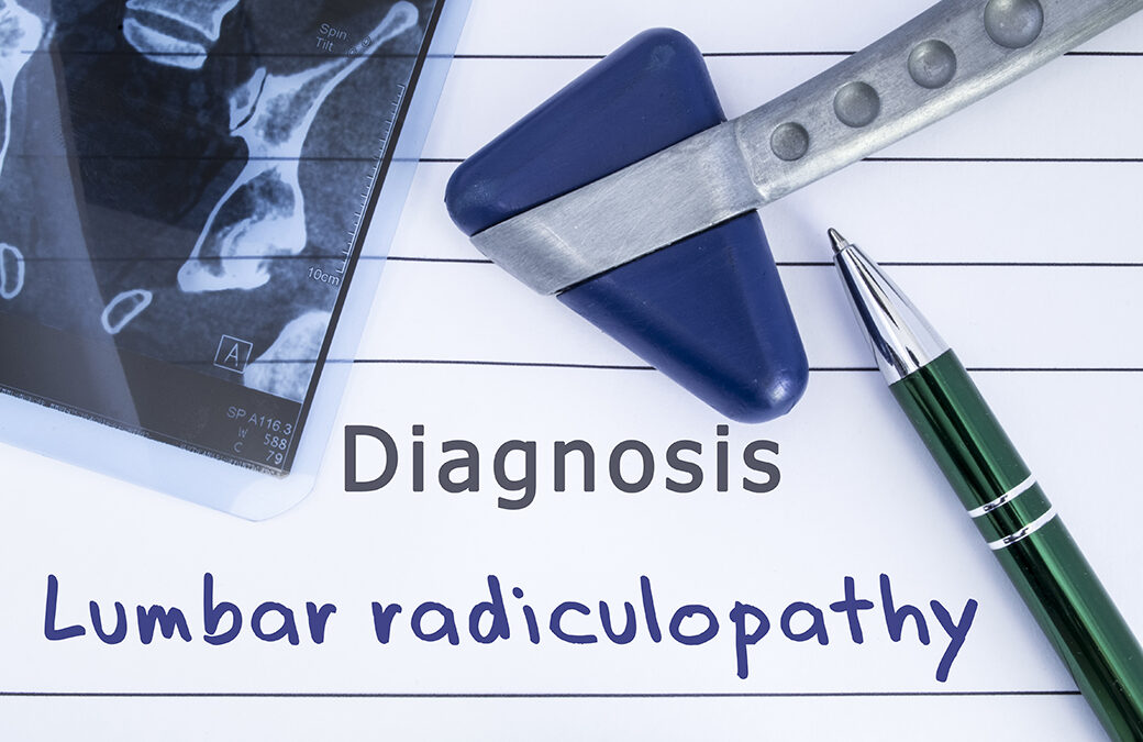 8 Things To Avoid When You Have Lumbar Radiculopathy
