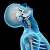The x-ray representation of ahead and the neck while a whiplash incident is happening.