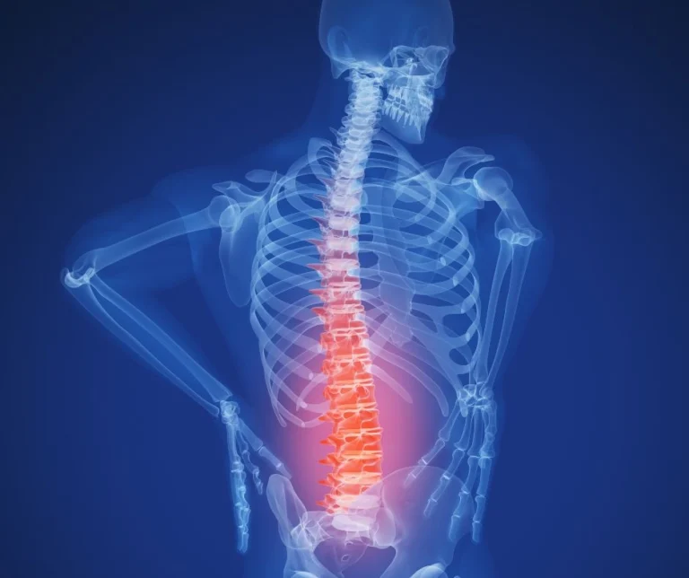 An x-ray styled image of a body with red highlight in the lower back.