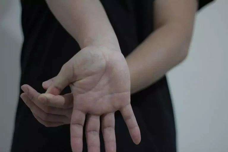 A hand being stretched from the fingers.