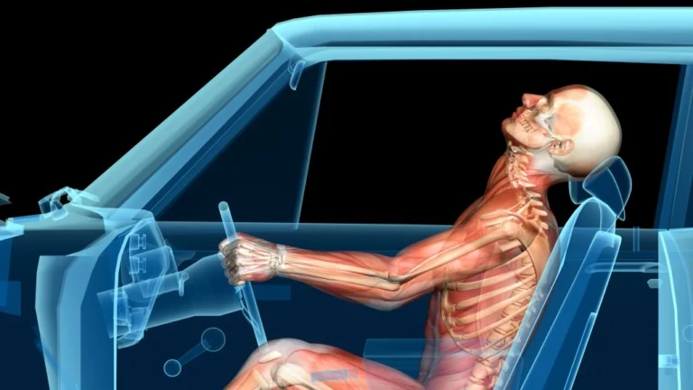 An x-ray image of a body getting whiplash in a car.