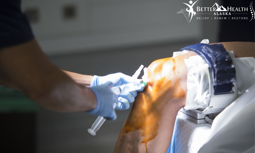 Arthroscopy